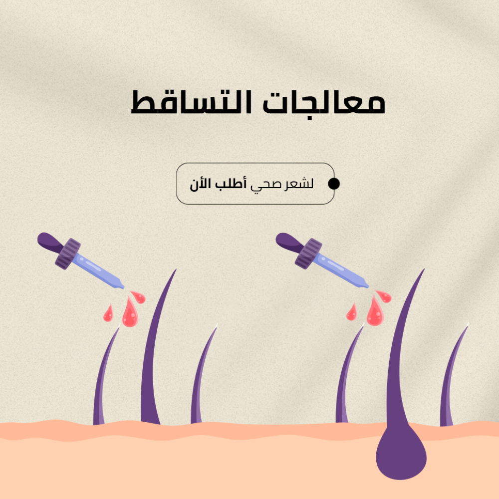 معالجات التساقط